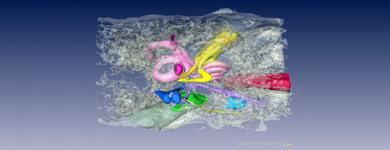 screen grab of temporal bone model