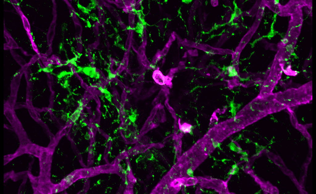 mircoglia in the retina