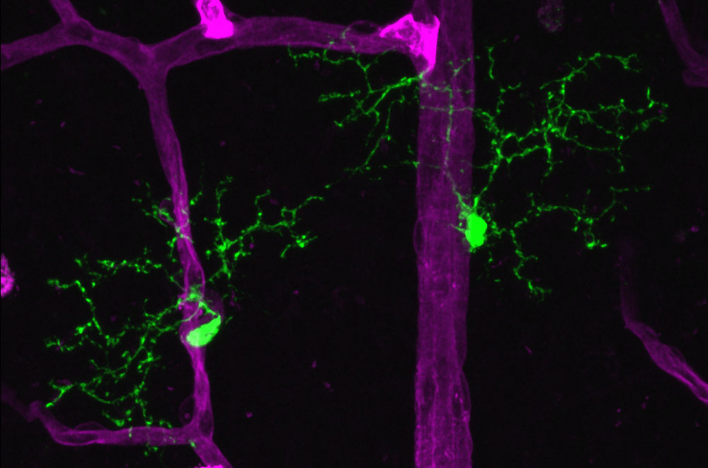 retinal microglia (green), the resident immune cell of the CNS, and the retinal vasculature (magenta), in a retinal flatmount