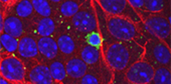 Elevated eye pressure caused T cell infiltration into the eye